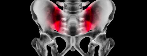 Radiofrequency Ablation | Conditions & Treatments | UCSF Health