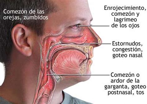 Una película en la mucosa nasal previene los síntomas la rinitis alérgica – Nuevo Crónica