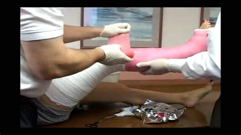 Application Long Leg Cast | Fiberglass Medical Leg Cast - YouTube