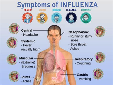 Recent Flu Symptoms 2024