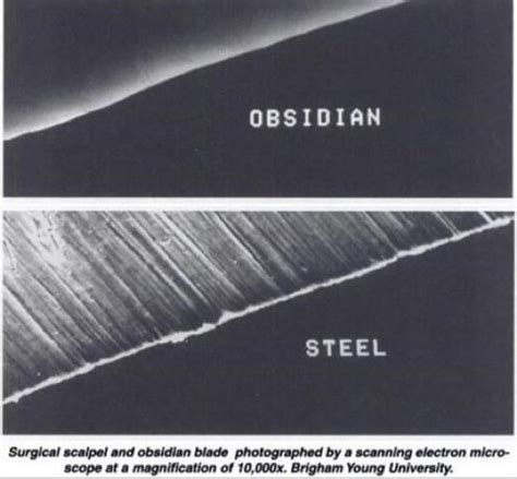 Steel vs Obsidian Surgical Blades Under an Electric Scanning Microscope ...