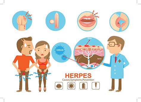 Syphilis Illustrations, Royalty-Free Vector Graphics & Clip Art - iStock