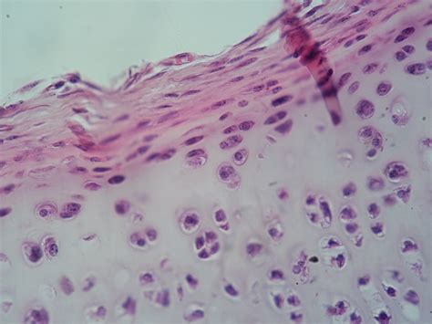 In microscopy a nucleus is normally stained using (a) Neutral red (b) Janus green B (c) Eosin (d ...