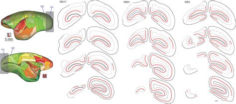 Planned extent and examples of primary visual cortex (V1) lesions.... | Download Scientific Diagram