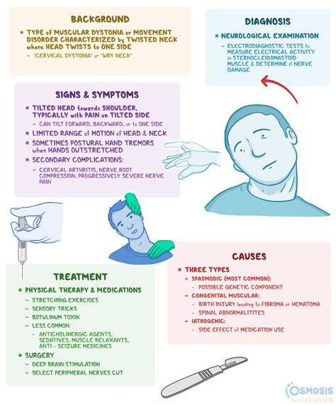 Torticollis: What Is It, Causes, and More | Osmosis