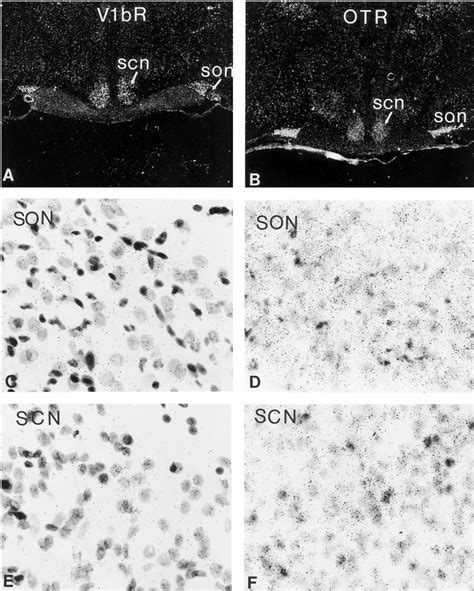 Supraoptic and suprachiasmatic nuclei of the hypothalamus. V1bR (left)... | Download Scientific ...