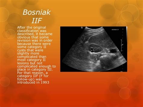 Bosniak Classification & Renal Cystic Disease