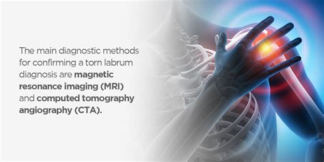 Torn Labrum of the Shoulder: Diagnosis and Treatments - Envision Radiology