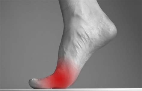 Plantar Plate Injury: Knowing the Symptoms and How to Treat It: Phoenix ...