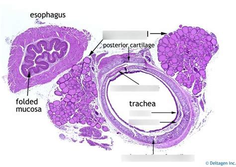 Histology Of Trachea Labeled