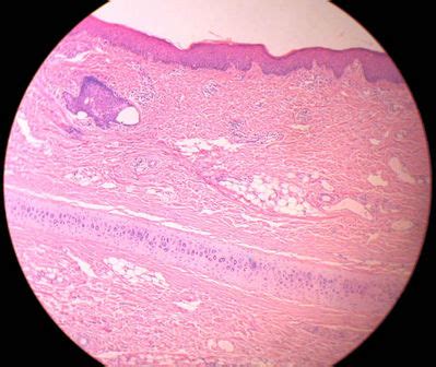 Ear Histology - External ear, monkey - histology slide