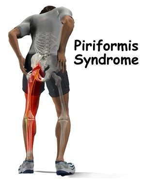 Get Rid of YOUR Hip Soreness/Pain Stretch Piriformis Stretch ...