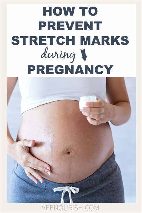 Learn how to prevent stretch marks during pregnancy with products like creams, lotions or oils ...