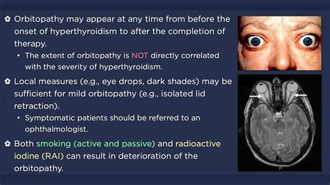 Hyperthyroidism: Graves' Orbitopathy - YouTube