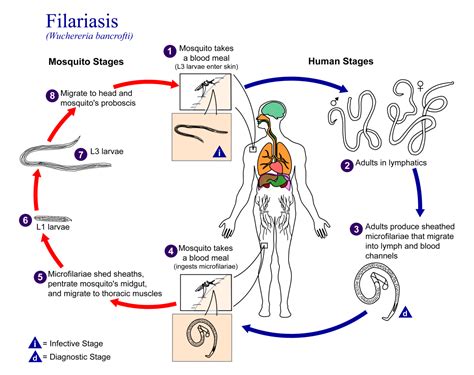 Filariasis Diagnosis, Treatment, Prevention - Rxharun