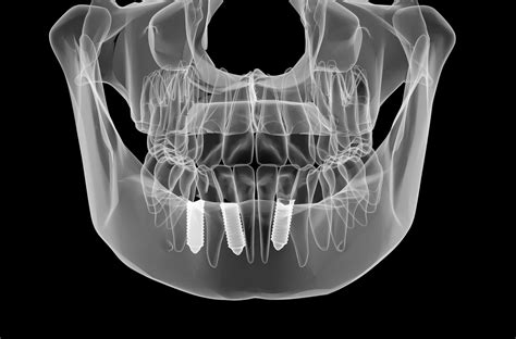 What’s the Benefit of Seeing a Dentist with a CT Scanner? – Fresno ...