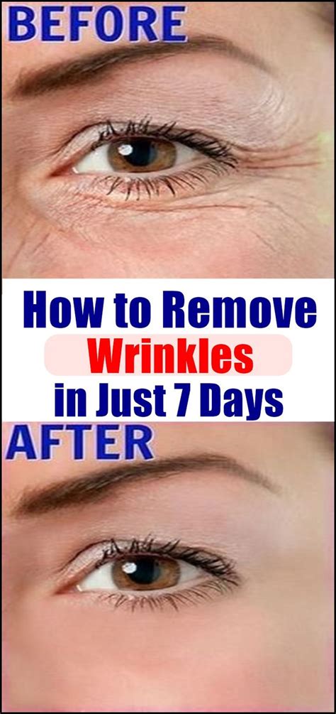 How to Remove Wrinkles Naturally in Just 7 Days – Holistic Life Course ...