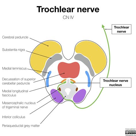 Radiopaedia - Drawing Midbrain at level of trochlear nerve - English ...