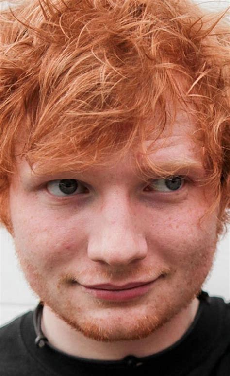 a close up of a person with frizz on his face and red hair