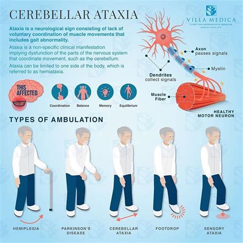 💡💡Learn more about ATAXIA ⤵️ • • What's Ataxia? Types of ambulation • • #neuro #neurology # ...