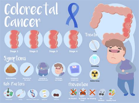 National Colorectal Cancer Awareness Month 2023: How to Prevent Colore — Mountainside Medical ...