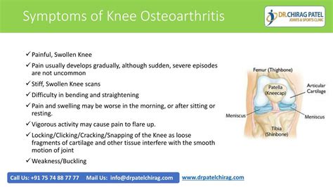 PPT - Knee Osteoarthritis Causes And Common Symptoms - Dr Chirag Patel,Surat. PowerPoint ...