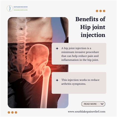 Hip Joint Injection – Preparation, Procedure, and Treatment in Southlake, Tx – South Lake Pain ...