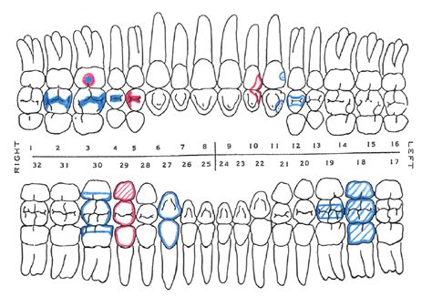 Image result for dental assistant study guide free | Dental charting, Dental assistant study ...