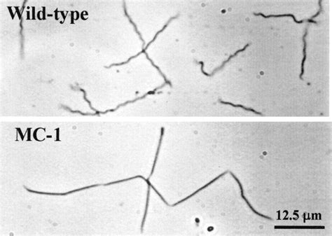 Borrelia Burgdorferi Microscope