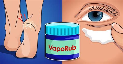 15 Unlikely Uses For Vicks VapoRub That Will Solve Your Biggest Problems