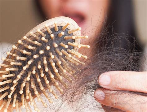 Experts Reveal The Surprising Reason Your Hair Is Falling Out—And How ...