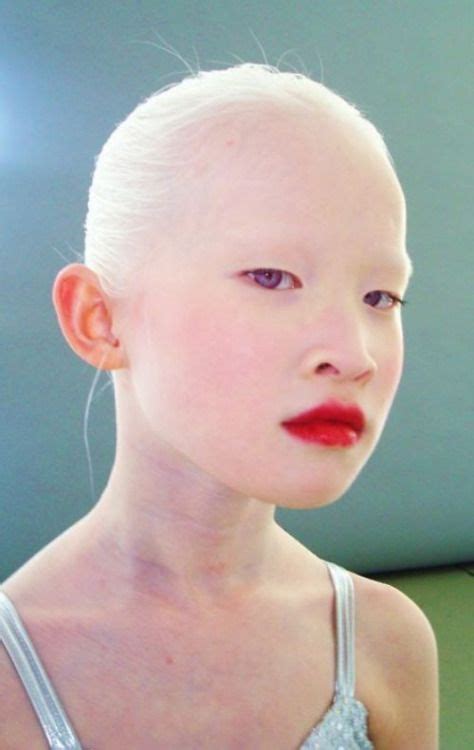 gracesean | Face, Interesting faces, Albinism