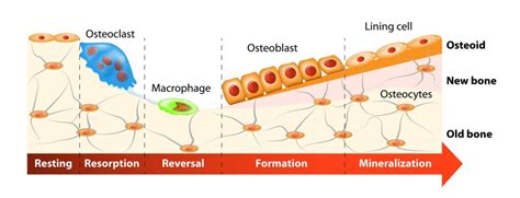 Distraction Osteogenesis for Oral & Facial Skeleton - Dr. Hennie Kloppers