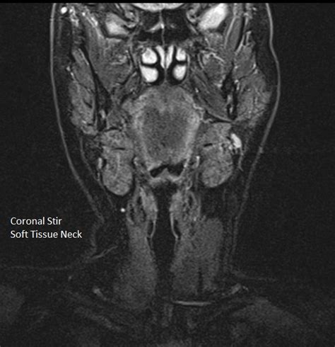 MRI Scan Images | Worcestershire Imaging Centre | Worcester MRI Scans