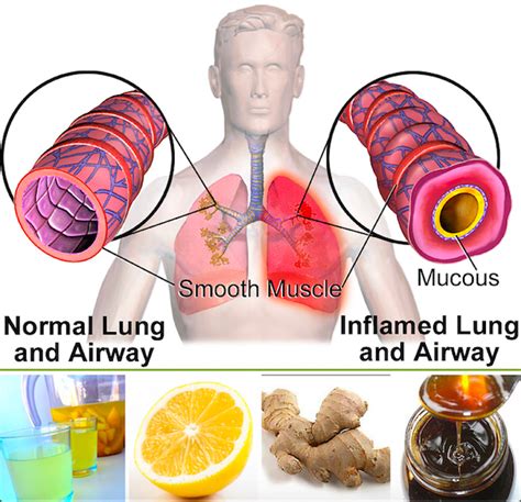 HOME REMEDIES FOR CHEST CONGESTION