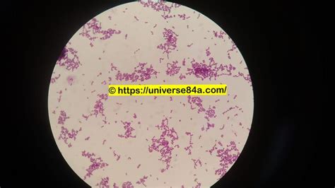 Streptococcus oralis: Introduction, Morphology, Pathogenicity, Lab