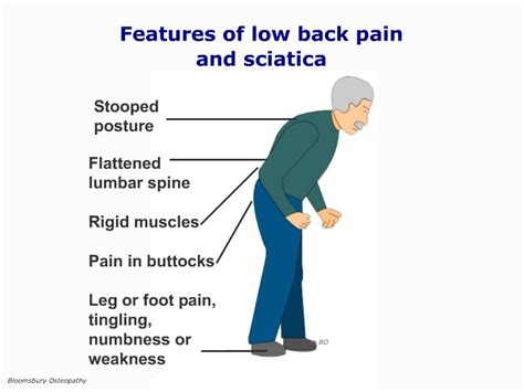 Acute Lower Back Muscular Spasm LSPP05 - Bloomsbury Health Centre