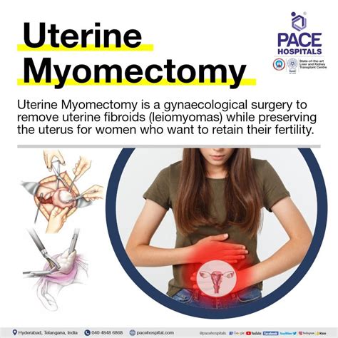 Myomectomy Surgery in Hyderabad - Indications, Side effects & Benefits