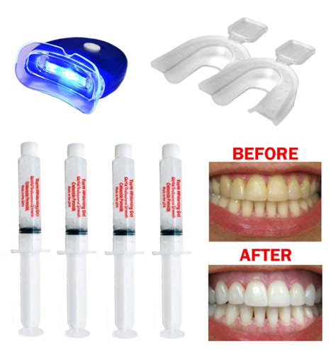 Complete Teeth Whitening Kit -Home System 22% Gel Syringe Kit - USA