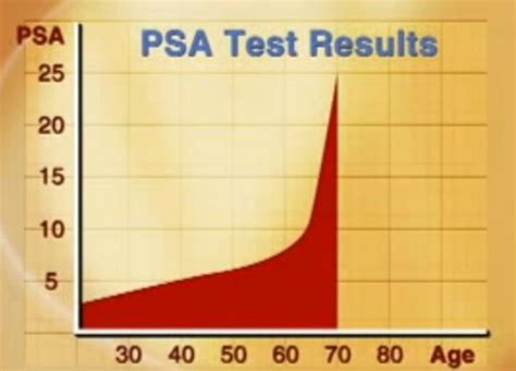 PSA Normal Range By Age, Causes of High Levels