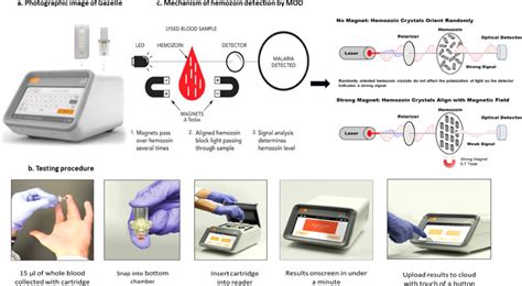 First successful field evaluation of new, one-minute haemozoin-based ...