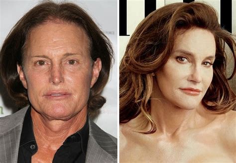 Bruce Jenner Before and After Transformation into Caitlyn Jenner