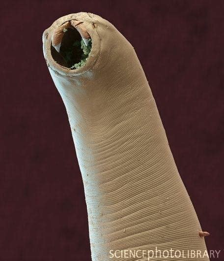 Hookworm by scanning electron micrograph (SEM) | Medical Laboratories