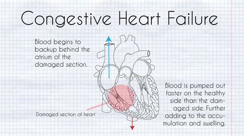 A Beginners Guide To Heart Disease — The Sunlight Experiment