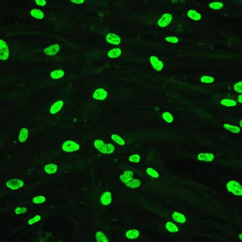 Why does my Hoechst 33342 Staining yield extra signals? | ResearchGate