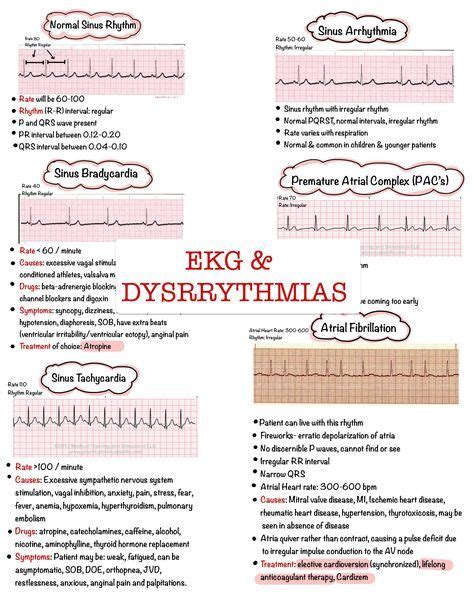 Basic EKG Dysrhythmias & Interpretation Nursing Notes 6 PAGES Digital Download PDF - Etsy UK ...