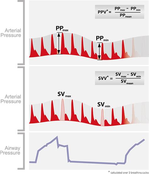 Non-Invasive Pulse Pressure Variation - CNSystems Medizintechnik GmbH