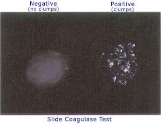 Coagulase Test: Principle, Procedure, Results • Microbe Online