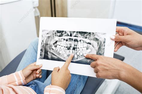 Examining dental X-ray - Stock Image - F034/9224 - Science Photo Library