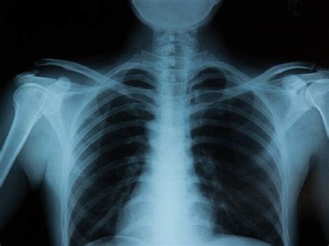 10 X-Rays Uses in Everyday Life – StudiousGuy